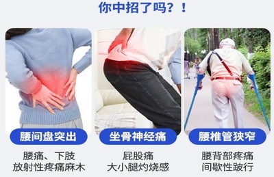 鐵腰板治療儀:真實經驗分享,真的可信嗎_靠譜_治愈_效果